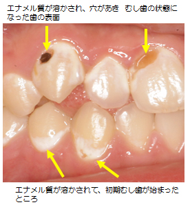 質 歯 再生 エナメル
