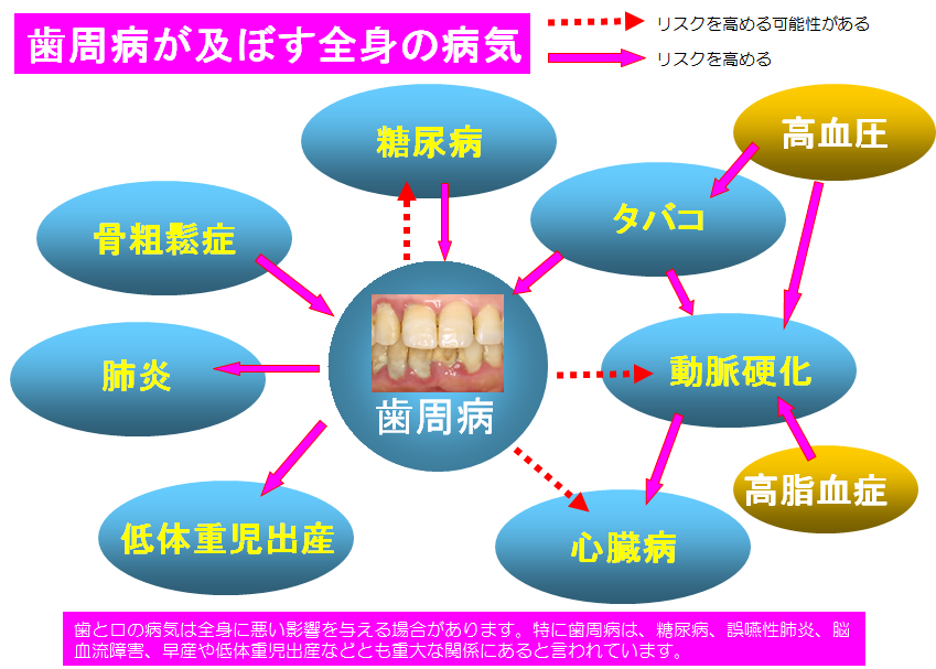 歯周病治療 歯科医はライフサポーター 酒田に2つの歯医者さん 五十嵐歯科医院